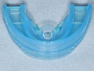 石神井公園駅のスヴァラ歯科のカラフルなマウスピース型の筋機能矯正装置